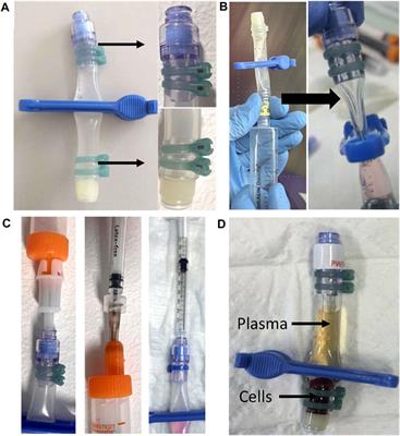 Monitoring functional immune responses with a cytokine release assay: ISS flight hardware design and experimental protocol for whole blood cultures executed under microgravity conditions